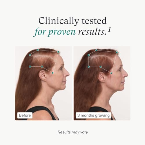 Nutrafol Women's Balance Hair Growth Supplements 3 Month Supply