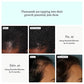 Nutrafol Women's Hair Growth Supplements 2 Refill Pouches 2 mo supply