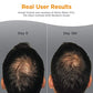 Viviscal Men's Hair Growth Supplement 180 Tablets - 3 Month Supply