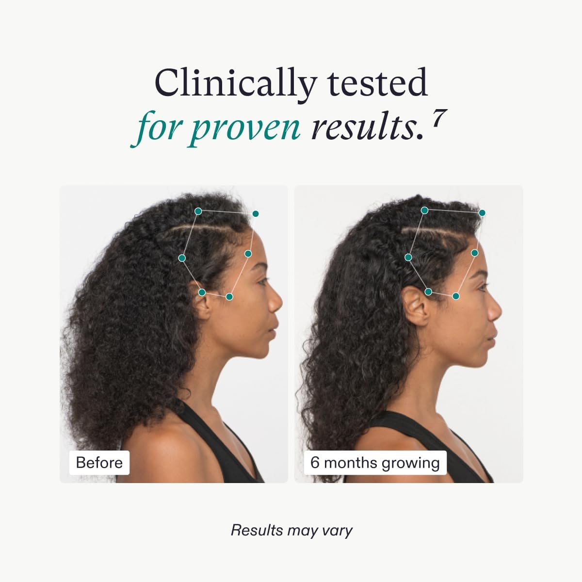 Nutrafol Women's Vegan Hair Supplements 120 Caps