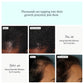 Nutrafol Women's Hair Growth Supplement 120 Capsules