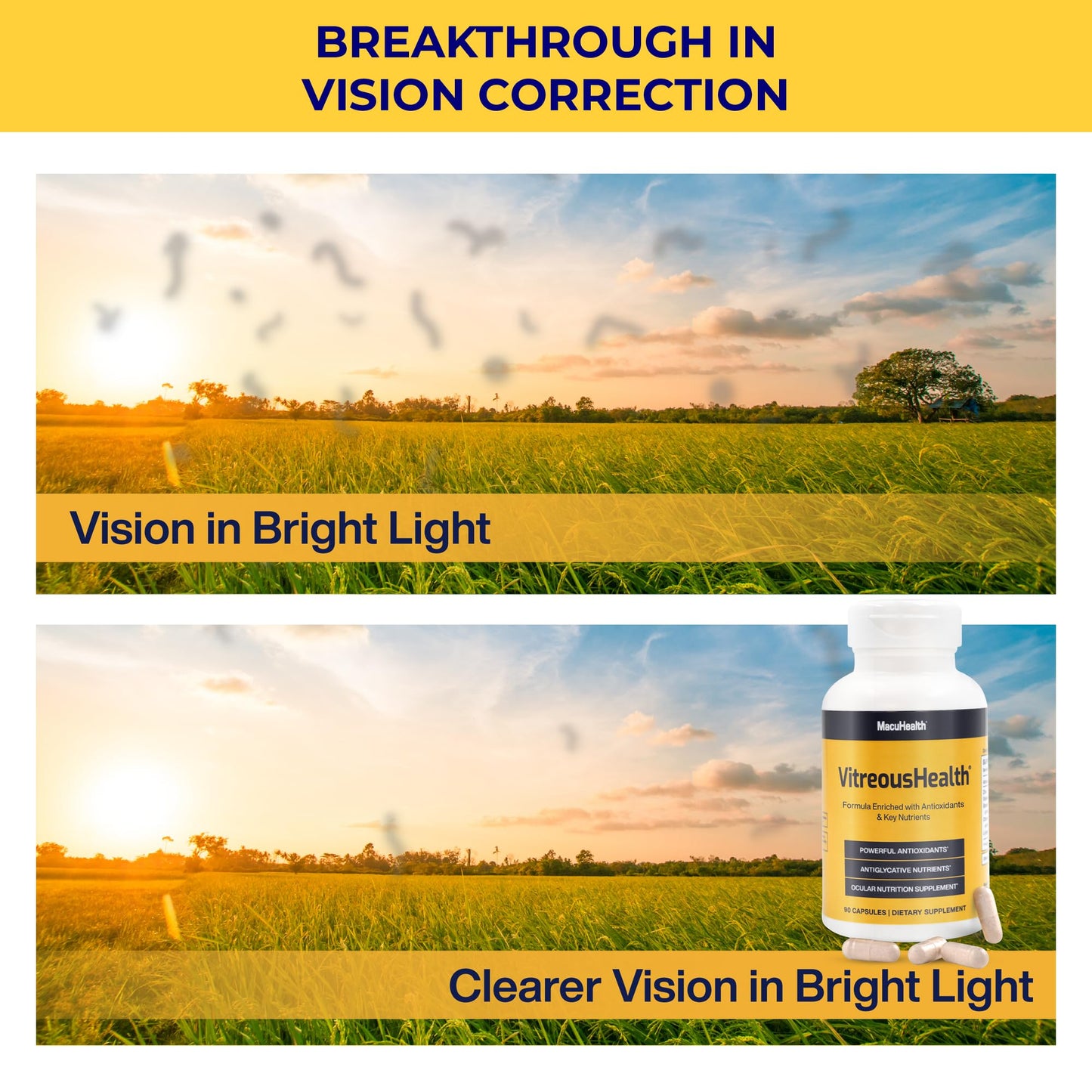 Macuhealth VitreousHealth Evidence-Based Eye Supplement - 90 Capsules USA Supplements Direct  B0CQ32H6X2